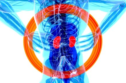 a blue and red jellyfish