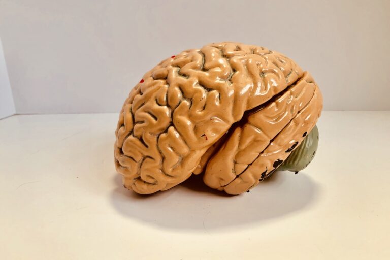 rTMS (Repetitive Transcranial Magnetic Stimulation) human brain figurine