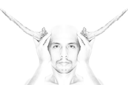 rTMS (Repetitive Transcranial Magnetic Stimulation) grayscale photo of man with right hand on head