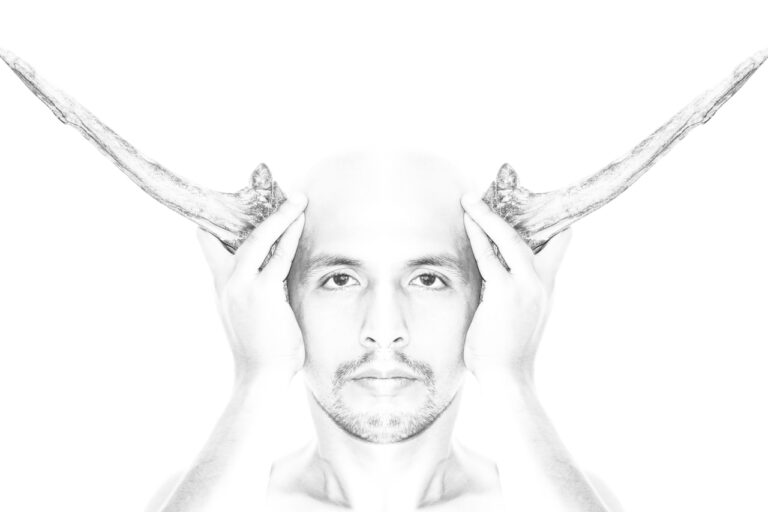 rTMS (Repetitive Transcranial Magnetic Stimulation) grayscale photo of man with right hand on head